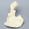 Hemi Pelvis with Wall Fractures, Solid Foam, Right