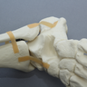 Pelvis with Leg, Full Female, Solid Foam and Foam Cortical