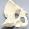 Pelvis with Dysplasia, Full Female, Solid Foam