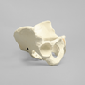 Pelvis with Dysplasia, Full Female, Solid Foam