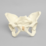 Pelvis with Dysplasia, Full Female, Solid Foam