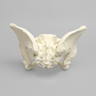 Pelvis with Dysplasia, Full Female, Solid Foam