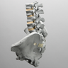 Lumbar Spine with Pelvis, Full Male, Radiopaque