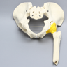 Pelvis with Acetabular Fractures and Femur, Full Male, Foam Cortical