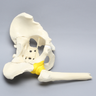 Pelvis with Acetabular Fractures and Femur, Full Male, Foam Cortical