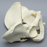 Pelvis with Sacral, Acetabular, and Column Fractures, Full Male, Foam Cortical