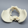 Pelvis with Sacral, Acetabular, and Column Fractures, Full Male, Foam Cortical