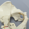 Pelvis with Sacral, Acetabular, and Column Fractures, Full Male, Foam Cortical