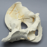 Pelvis with "T" and Both-Column Fractures, Full Male, Foam Cortical