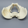Pelvis with "T" and Both-Column Fractures, Full Male, Foam Cortical