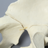 Pelvis with "T" and Both-Column Fractures, Full Male, Foam Cortical