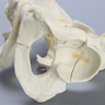 Pelvis with Fractures, Full Male, Foam Cortical