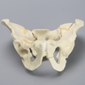 Pelvis with Fractures, Full Male, Foam Cortical