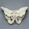 Pelvis with Posterior Wall Fracture, Full Male, Foam Cortical