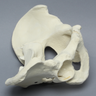 Pelvis with Posterior Wall Fracture, Full Male, Foam Cortical