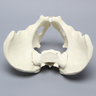 Pelvis with Acetabular Fractures, Full Male, Foam Cortical