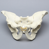 Pelvis with Acetabular Fractures, Full Male, Foam Cortical