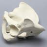 Pelvis with Acetabular Fractures, Full Male, Foam Cortical
