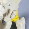 Pelvis with Acetabular Fractures, Fragment, and Femur, Full Male