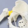 Pelvis with Acetabular Fractures, Fragment, and Femur, Full Male