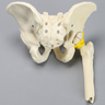 Pelvis with Acetabular Fractures, Fragment, and Femur, Full Male