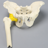 Pelvis with Both Column Fracture and Encapsulated Femur, Full Male