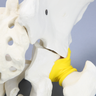 Pelvis with "T" Fracture, Displacement, and Encapsulated Femur, Full Male