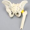 Pelvis with "T" Fracture, Displacement, and Encapsulated Femur, Full Male