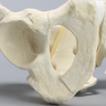 Pelvis with Sacral and Rami Fractures with Displacement, Full Male, Foam Cortical