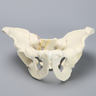 Pelvis with Sacral and Rami Fractures with Displacement, Full Male, Foam Cortical