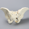 Pelvis with Sacral and Rami Fractures with Displacement, Full Male, Foam Cortical