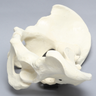 Pelvis, Salter's Osteotomy, Full Male, Foam Cortical