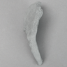 Iliac Crest, Radiopaque, Left