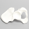 Hemi Pelvis, Female, Solid Foam, With Dysplasia, Left
