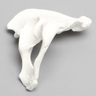 Hemi Pelvis, Female, Solid Foam, With Dysplasia, Left