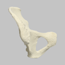 Hemi Pelvis, Female, Solid Foam, With Dysplasia, Left