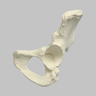 Hemi Pelvis, Female, Solid Foam, With Dysplasia, Left