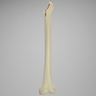 Femur with Segmental Defect and Perforated Wall