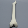 Femur with Focal Deficiency Type 3