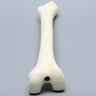 Femur with Focal Deficiency Type 2