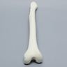 Femur with Cortex Wall Loss