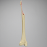 Femur with Focal Deficiency Type 4