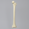 Femur with 155 Degree Neck Deformity