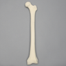 Femur with 135 Degree Neck Deformity
