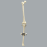 Knee Joint with Adjustable Collateral Ligaments Knee Joint with Adjustable Collateral Ligaments