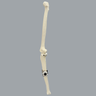 Knee Joint with Adjustable Collateral Ligaments Knee Joint with Adjustable Collateral Ligaments