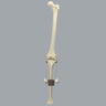 Knee Joint with Adjustable Collateral Ligaments Knee Joint with Adjustable Collateral Ligaments