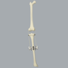 Knee Joint with Adjustable Collateral Ligaments Knee Joint with Adjustable Collateral Ligaments