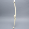 Knee with Two Collateral Ligaments and Narrow Intercondylar Notch, Full Length
