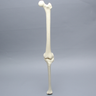 Knee with Two Collateral Ligaments and Narrow Intercondylar Notch, Full Length